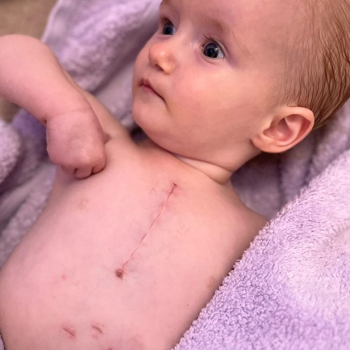 My Heart Defects: Brianna’s Story